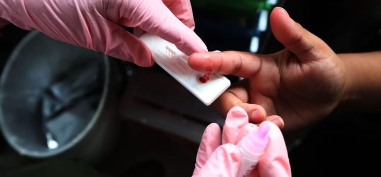 Ocupa Quintana Roo, primer lugar nacional en casos nuevos de VIH